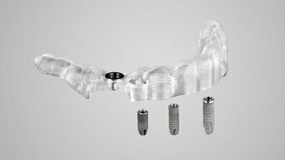 Dentsply Sirona Implants lancia Acuris, l’innovazione più recente nel campo dell’implantologia