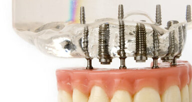 «Έξυπνη» επίστρωση για οδοντιατρικά εμφυτεύματα