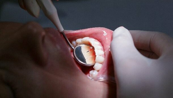 Mensen met laag inkomen gaan minder naar tandarts