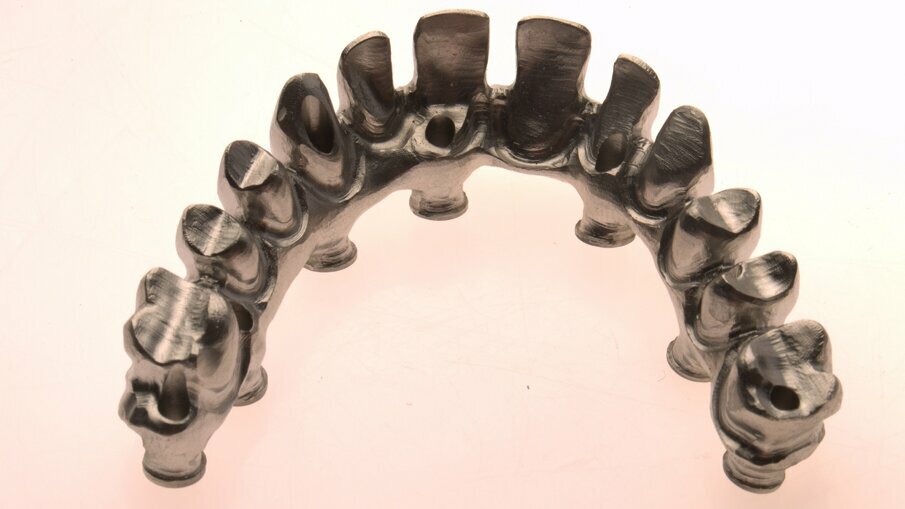 Full-arch rehabilitation with lithium disilicate secondary crowns_5b