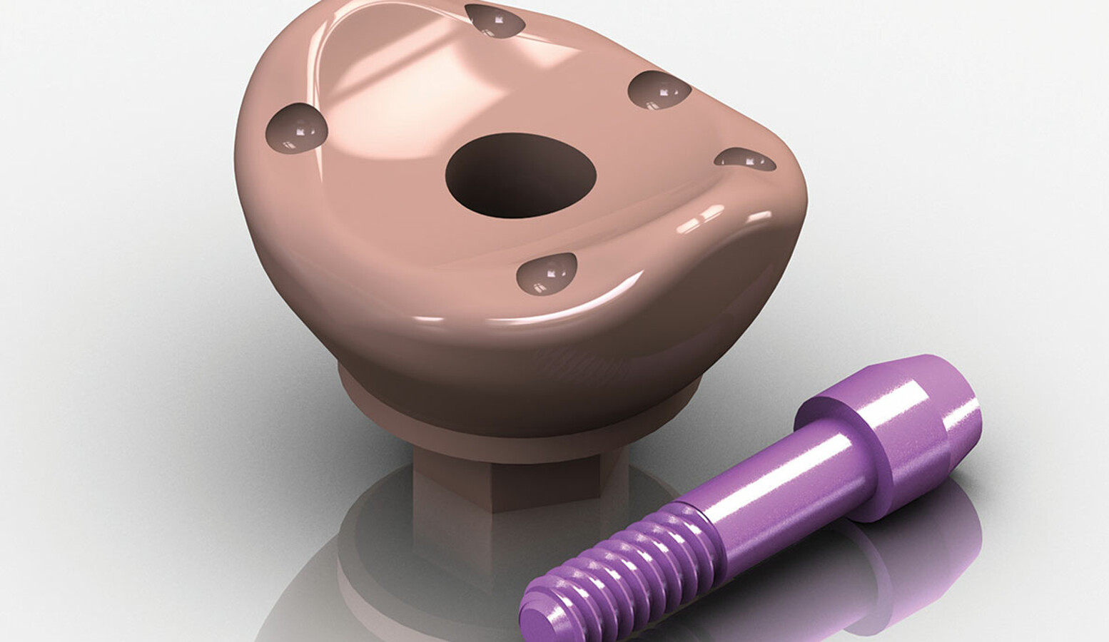 Introducing the Anatotemp SC digitally scannable anatomic dental implant healing abutments