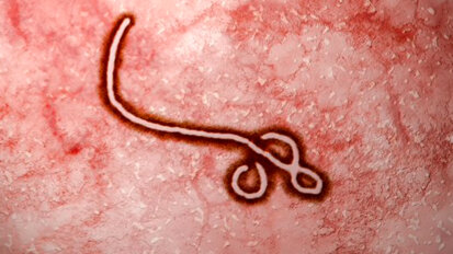 Preporuke za stomatologe u vezi sa širenjem ebola virusa