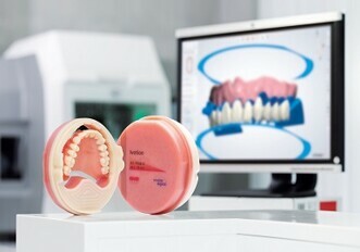 Ivoclar – Ivotion Denture System
