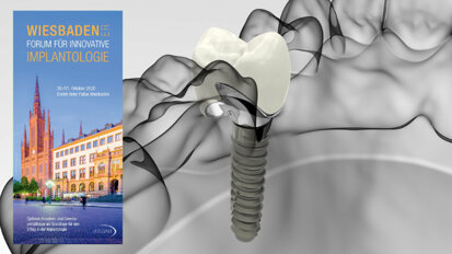 Wiesbadener Forum für Innovative Implantologie im Oktober