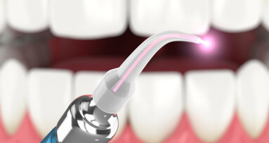 Lasery v ortodoncii: Zlepšení kvality péče a úspora času díky ošetření laserem