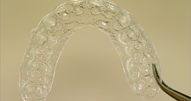 eCligner—aesthetic orthodontic appliance