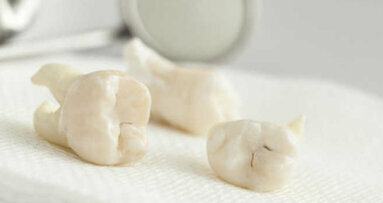 Profissionais podem fazer doação de dentes durante o CIOSP