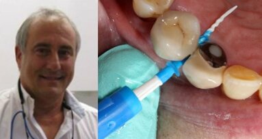 专访Allan Coopersmith医生：“用牙线洁牙是一项既难学又难教的牙齿日常保洁措施”