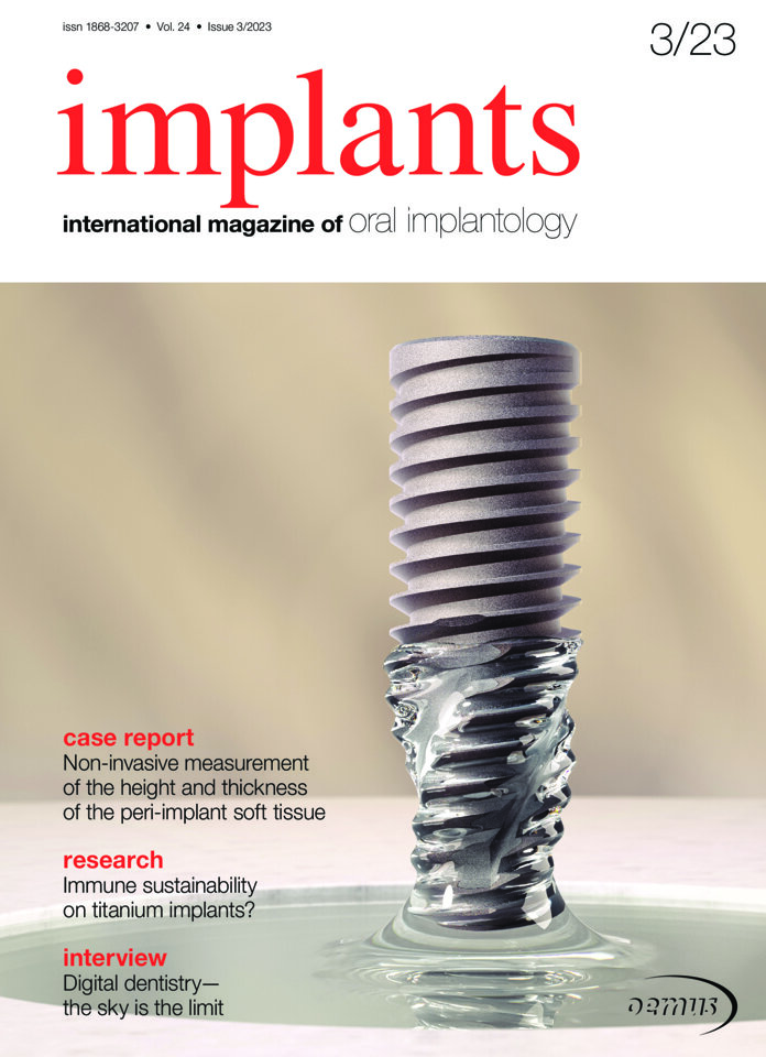 Dental Tribune E-Paper Edition - Implants International