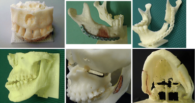 Researchers develop environment for manufacture of inexpensive 3-D dental models