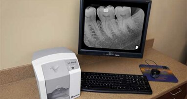 Endodontics made more efficient with the ScanX Swift