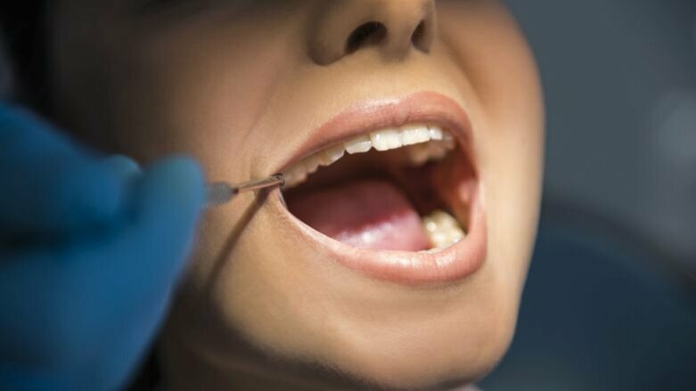 73% van de patiënten liegt tegen tandarts