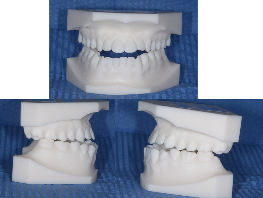 Fig. 3 - Esempio di modelli studio ottenuti con stampa 3D.