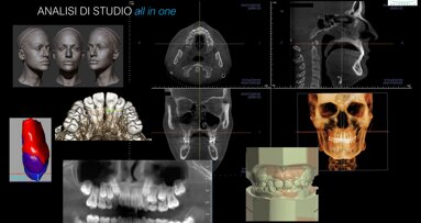 L’ortodonzia oggi tra 2D e 3D vive il presente e guarda al futuro