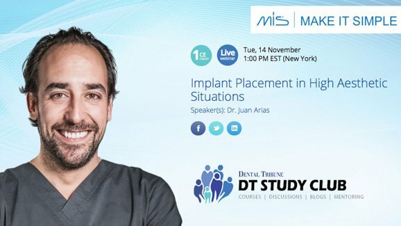Free webinar: Expert to lecture on implant placement in the aesthetic zone