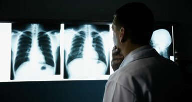 Des chercheurs espèrent développer un test de l’haleine pour le diagnostic du cancer du poumon