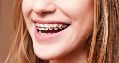 Aparat ortodontyczny jest modny i trendy!