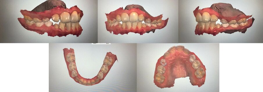 Fig. 1 - Esempio di immagini di scansione delle arcate dentarie.