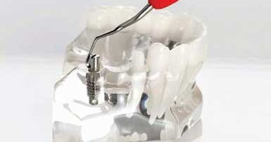 LM-Dental – ErgoMix Mini Implant Instruments