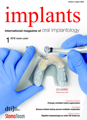implants Czech Republic No. 1, 2018