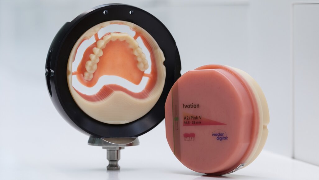 Ivoclar ed exocad ampliano le opzioni per le protesi digitali con l'integrazione in DentalCAD