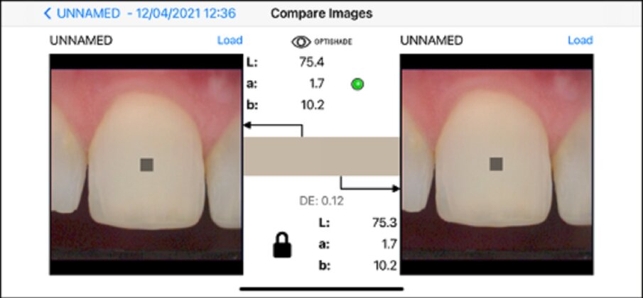 Fig. 11a: Same tooth, same surface (clean), same time frame, same positioning, same device, same background. Shade difference: 0.12. Reliable measurement.