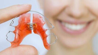Aparaty retencyjne utrwalą efekt leczenia ortodontycznego