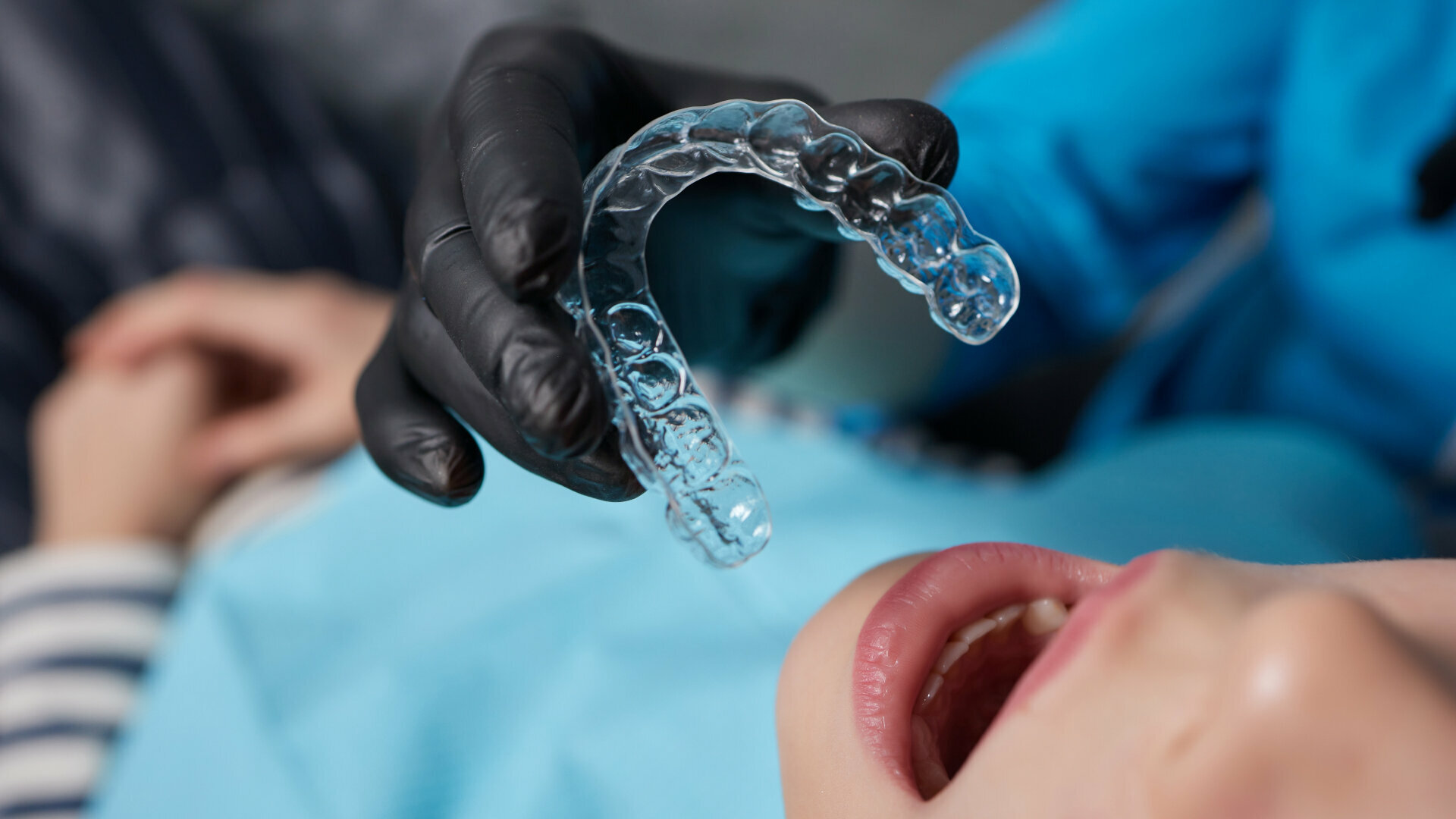 Drop in orthodontic case starts spooks Align Technology investors