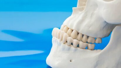 Ортогнатната хирургия за корекция на прогнатия на долната челюст е ефективна за подобряване качеството на живот на пациентите