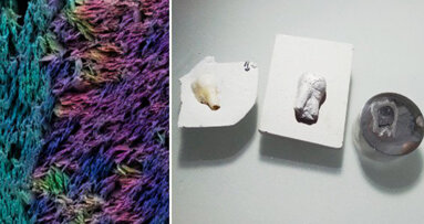 Creato in Svizzera un dente artificiale che imita la microstruttura naturale