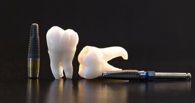 Naukowcy z Podlasia opracowują nowe implanty stomatologiczne