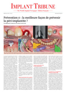Implant Tribune France No. 2, 2020