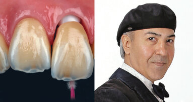The art of ultra-aesthetic dentistry
