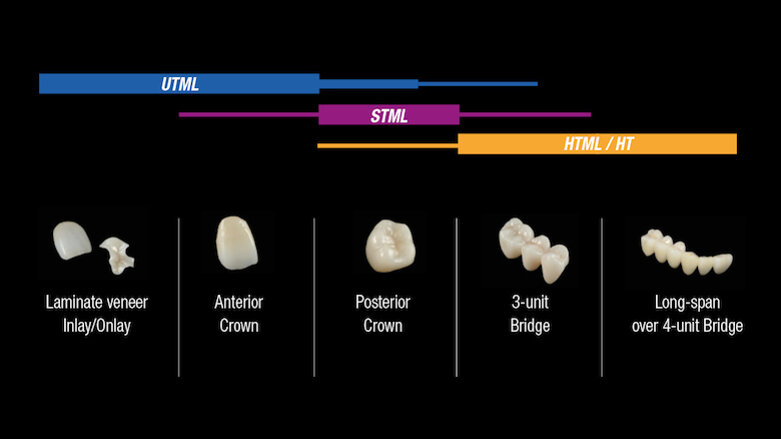 Multilayered zirconia in different translucency levels