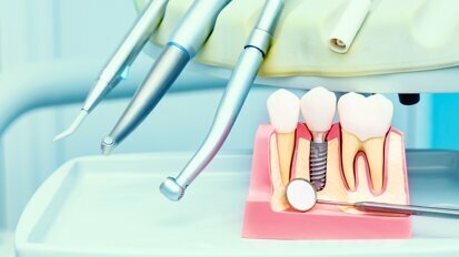 Taking stock and looking ahead—the current and future dental implant landscape