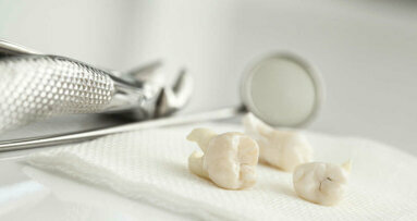 En Inde, un chirurgien-dentiste extrait 526 dents de la bouche d’un enfant
