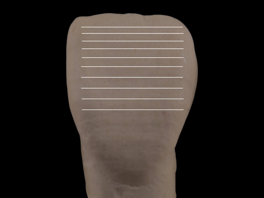 Fig. 8 - Le linee orizzontali fanno apparire il dente più largo, con una progressiva espansione della forma legata alla lunghezza delle linee e alla distanza tra di esse.