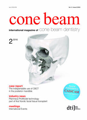 cone beam international No. 2, 2016