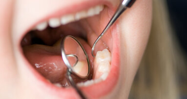 Studie belegt Wirksamkeit der parodontalen Prophylaxe