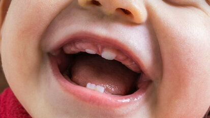 New study on primary dentition takes first steps toward early autism diagnosis