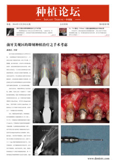 Implant Tribune China No. 4, 2014