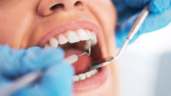 Research on using oral bacteria transplant to prevent tooth decay