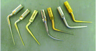 Management of Intracanal Separated Instruments