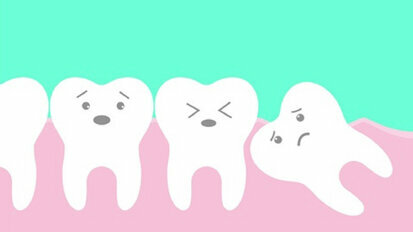 Early removal of unerupted wisdom teeth results in positive gum outcomes
