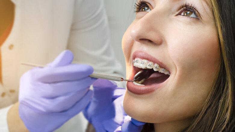 Survey shows number of UK adults seeking orthodontic treatment remains high