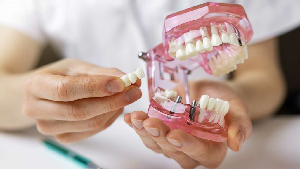 Krankenkasse und Zahnersatz: Was ist ein Härtefall?