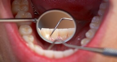 FGDP(UK) leads campaign encouraging screening for erosive tooth wear