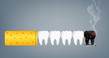 Schadensminderung beim Rauchen – Welche Rolle können Zahnmedizinerinnen und Zahnmediziner einnehmen?