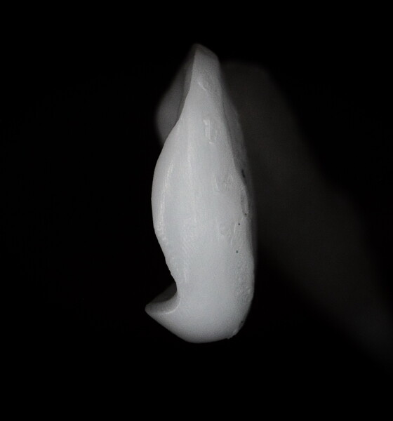 Fig. 14: 3D-printed veneer for tooth #22, proximal view.