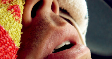 Research calls on dentists to increase role in treating sleep-related disorders